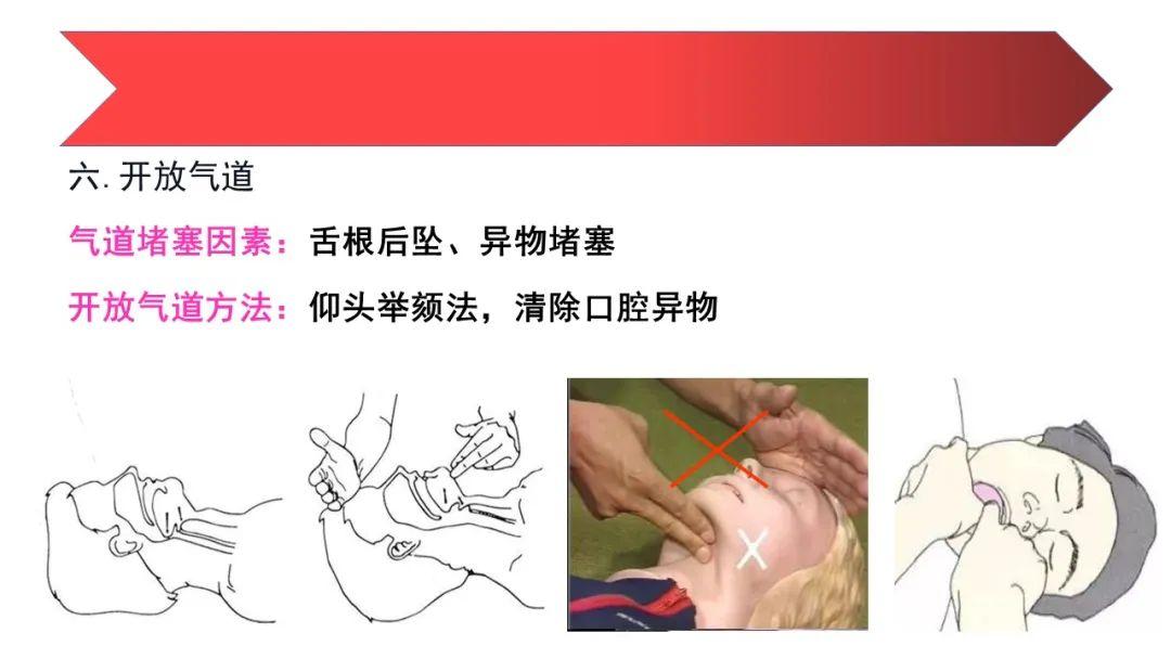 科技重塑儿童生命守护体系，最新版儿童心肺复苏PPT揭秘未来医疗科技进展